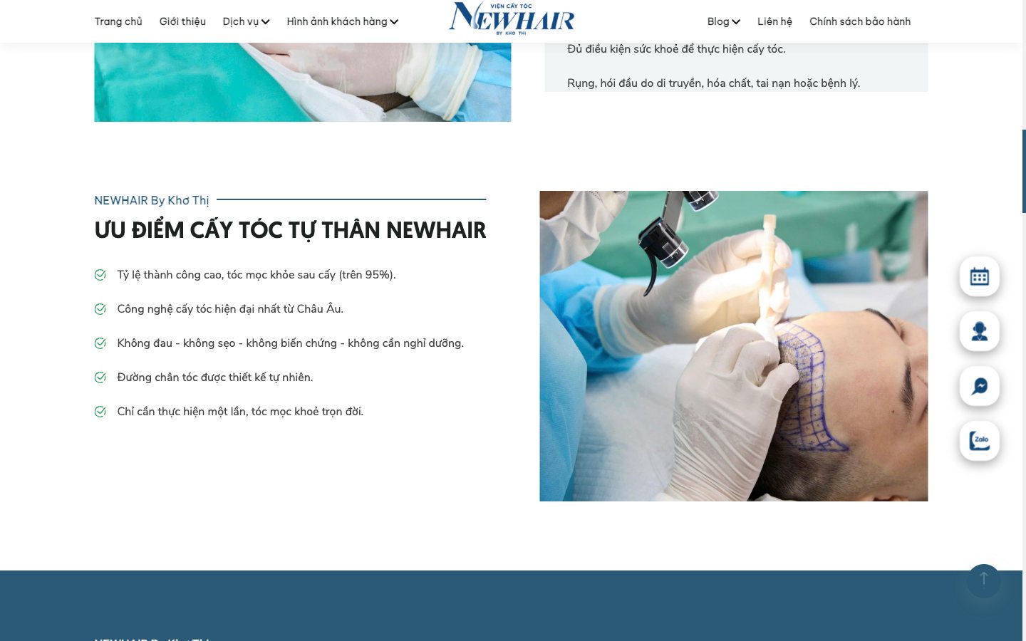 Trang 5 website NewHair by Khơ Thị - Website viện cấy tóc tự thân